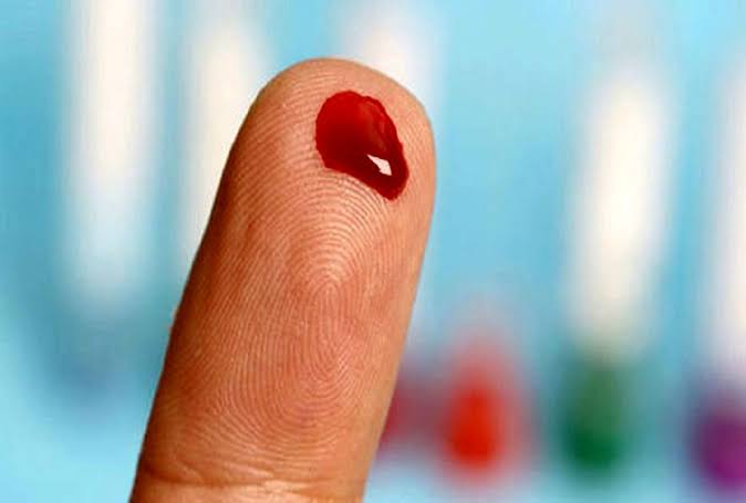 سرطان خون؛ علائم اولیه، انواع لوسمی و راههای تشخیص و درمان