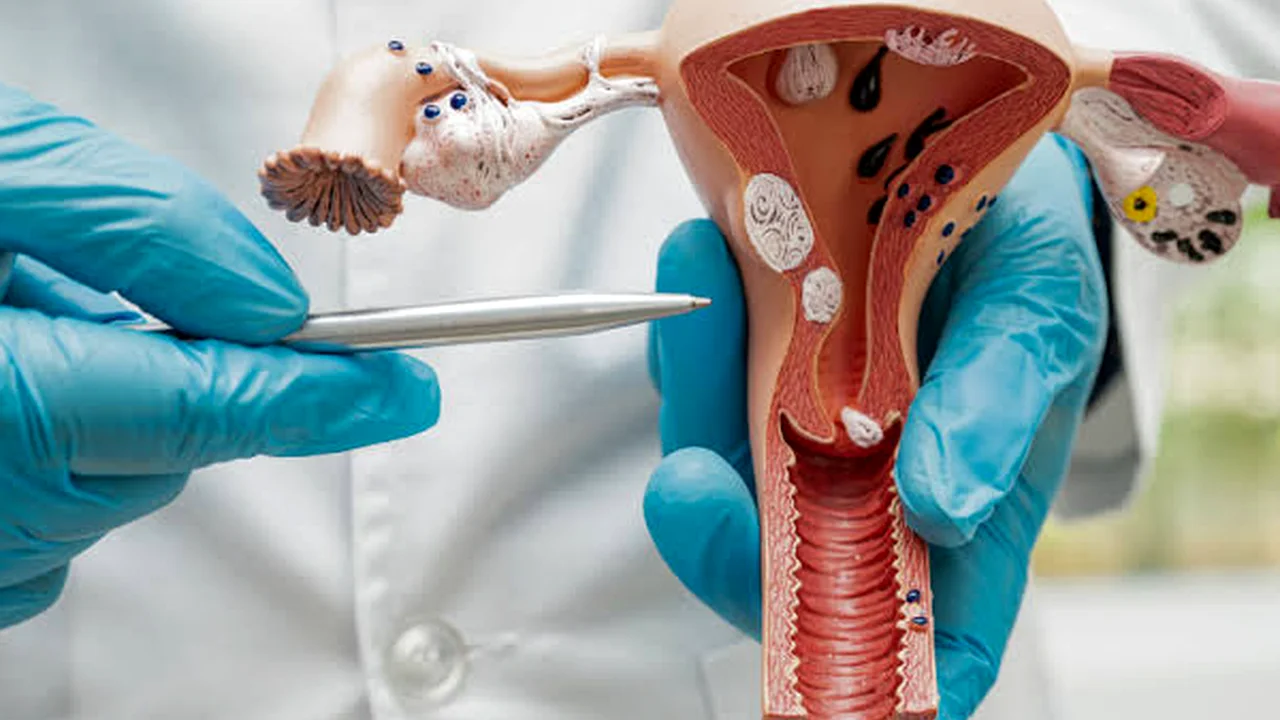 HPV چیست؟ علائم و راه های انتقال و تقویت سیستم ایمنی بدن برای درمان و کنترل بیماری