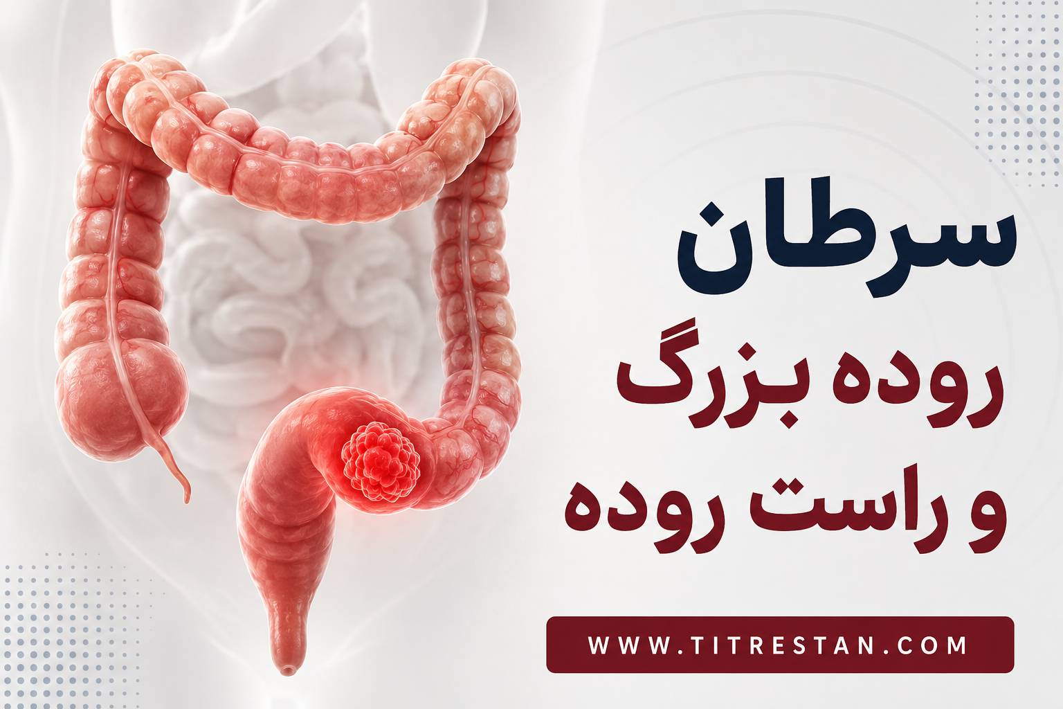 سرطان روده بزرگ چگونه خودش را نشان میدهد؟ از خون در مدفوع تا تغییر اجابت مزاج