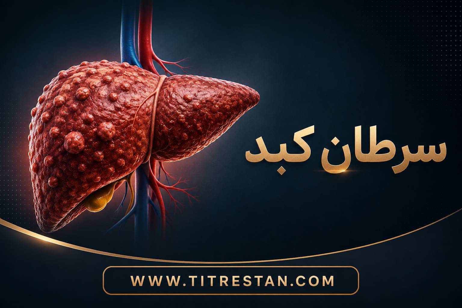 سرطان کبد چیست؟ علائم، علت، عوامل خطر و راههای درمان