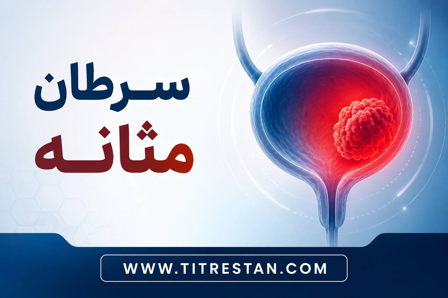 سرطان مثانه چیست؟ علائم، علل، عوامل خطر و روشهای درمان