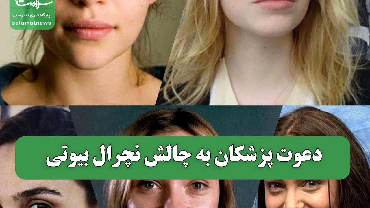 دعوت پزشکان به چالش نچرال بیوتی